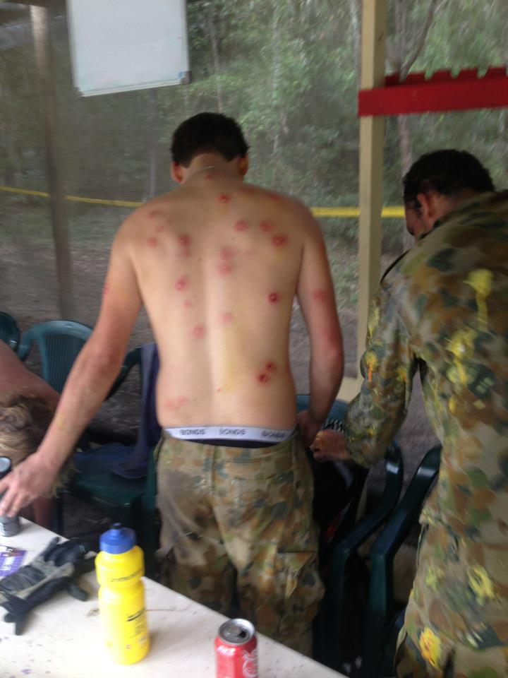 Play paintball they said, it doesn't hurt at all they said 