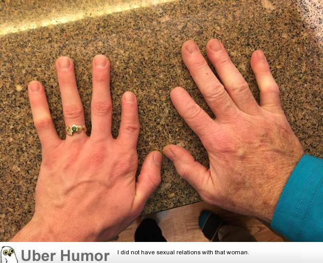 My dad's index tip was cut off when he was 10, my index is shorter than my  pinky | Funny Pictures, Quotes, Pics, Photos, Images. Videos of Really Very  Cute animals.