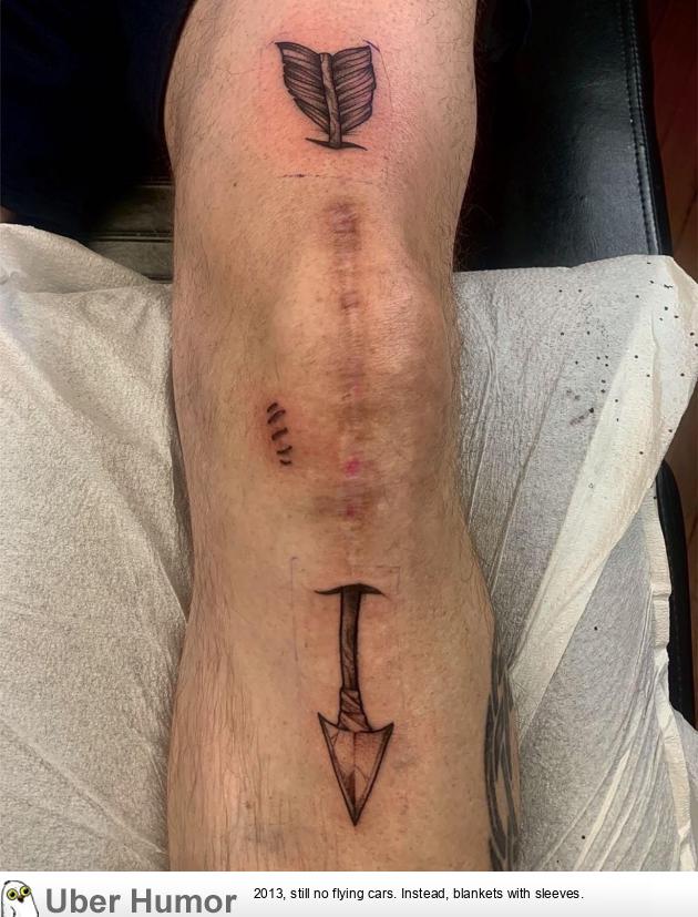 Finally did something creative with my knee replacement scar. | Funny  Pictures, Quotes, Pics, Photos, Images. Videos of Really Very Cute animals.